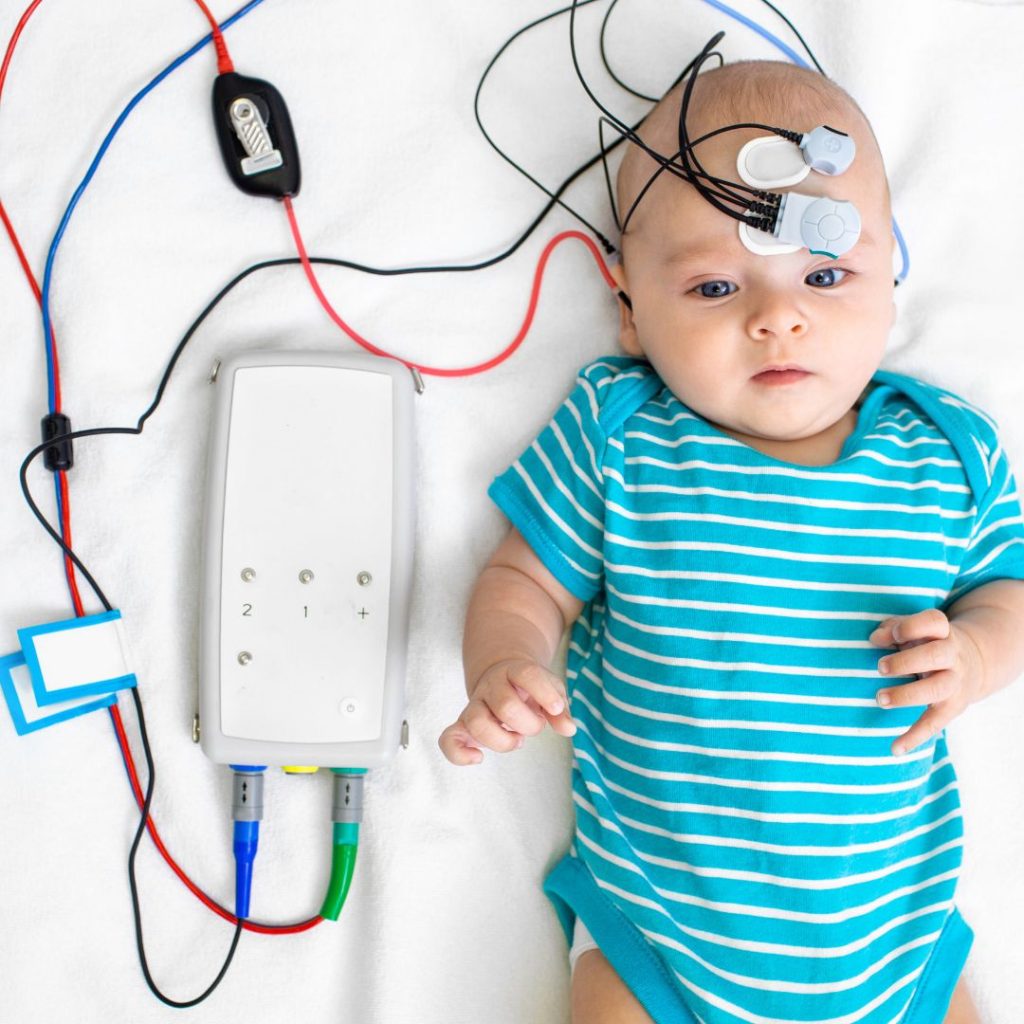 Auditory Brainstem Response (ABR)