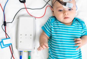 Auditory Brainstem Response (ABR)
