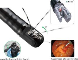 دئودنوسکوپ‌Duodenoscope