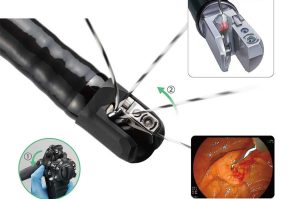 دئودنوسکوپ ‌Duodenoscope