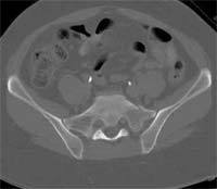 CT-SCAN