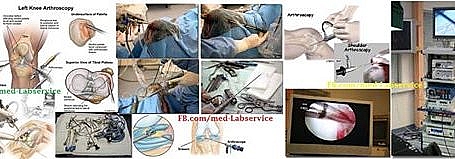 Arthroscopy