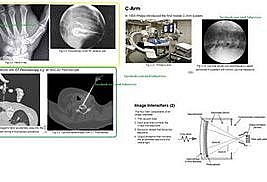 Fluoroscopy