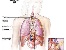 Pathophysiology of Non-small Cell Lung Cancer