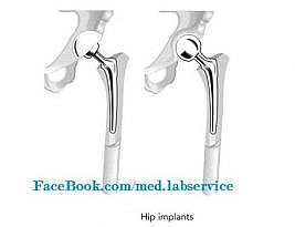 مفصل Hip
