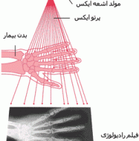تاریکخانه در تصویربرداری پزشکی