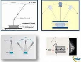 ماموگرافی دیجیتال سه بعدی