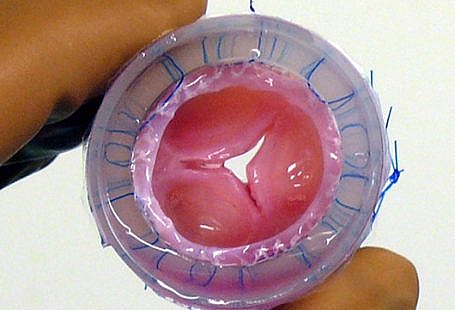 Heart Valve Tissue Engineering